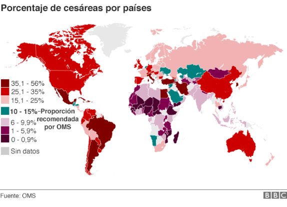 cesarea