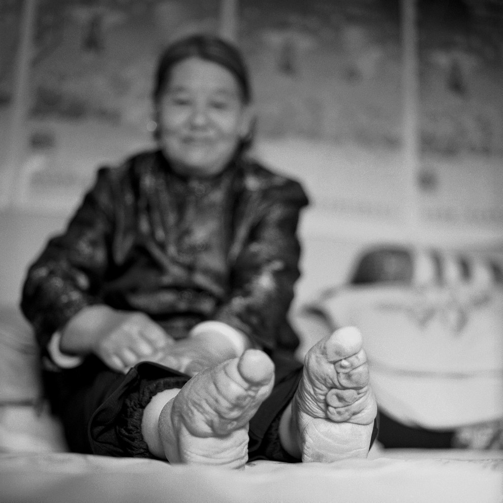 FOTOS | El fin de la dolorosa tradición de vendar los pies de las mujeres  chinas - El Dínamo