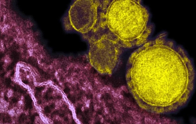 coronavirus Estados Unidos